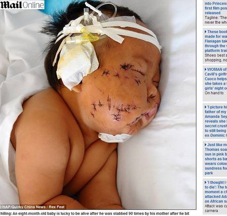 Imagem Bebê leva 90 tesouradas da mãe porque mordeu seu seio 