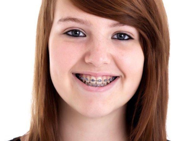 Imagem Adolescente põe absorvente e morre no País de Gales